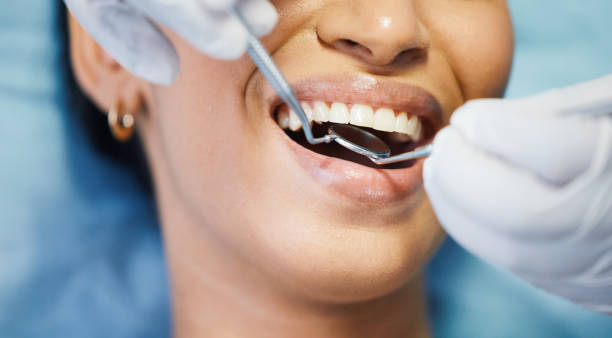 Best After-Hours Dental Trauma Care in Darien Downtown, CT